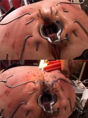 Hot anal destruction