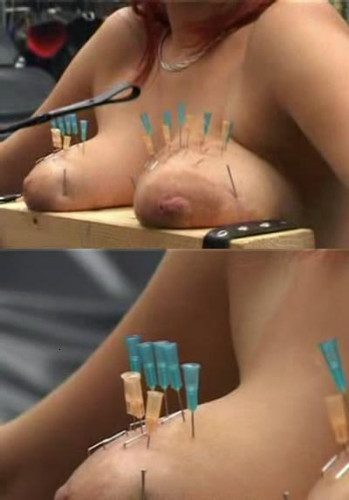 Stapler, nails and needles-really dangerous
